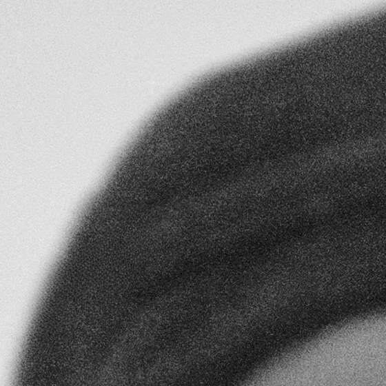 Detail 1, after