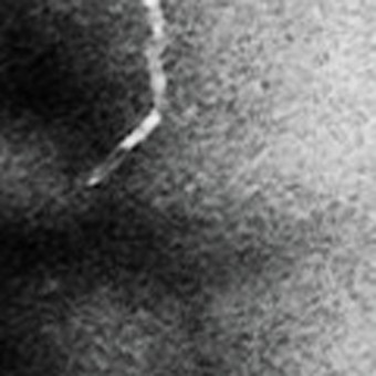 Before: a hair on grainy film